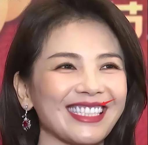 女明星烤瓷牙_明星烤瓷牙翻车_烤瓷牙的女明星